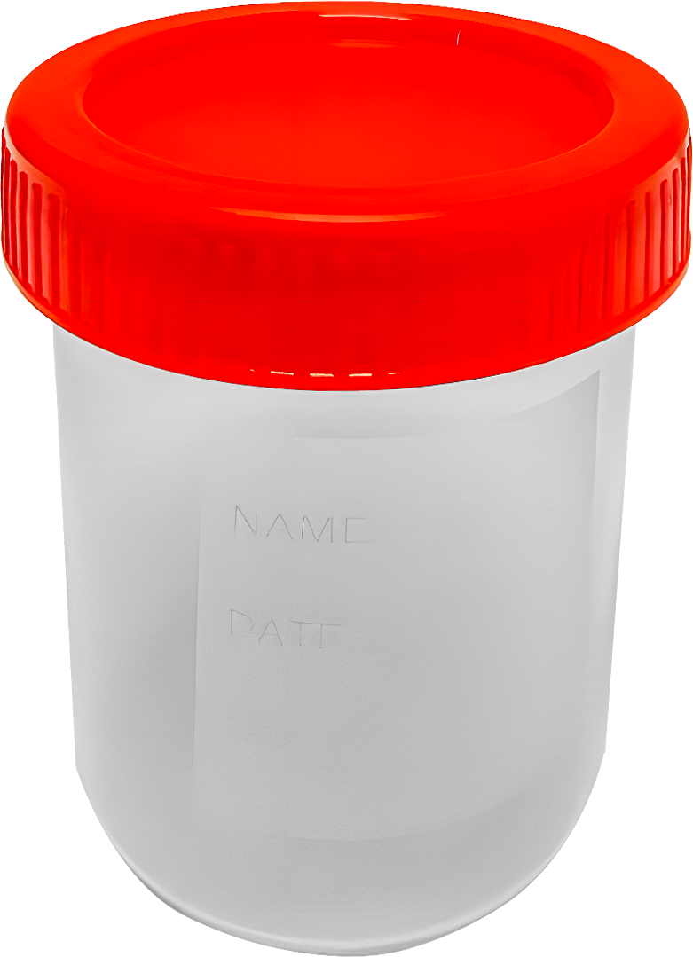 Vaso Recolector 100 ml Estéril — Tapa Roja
